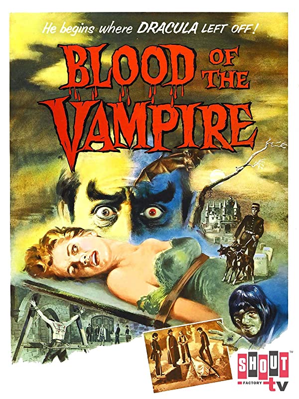 Blood Of The Vampire (1958) starring Donald Wolfit, Vincent Ball, Barbara Shelley
